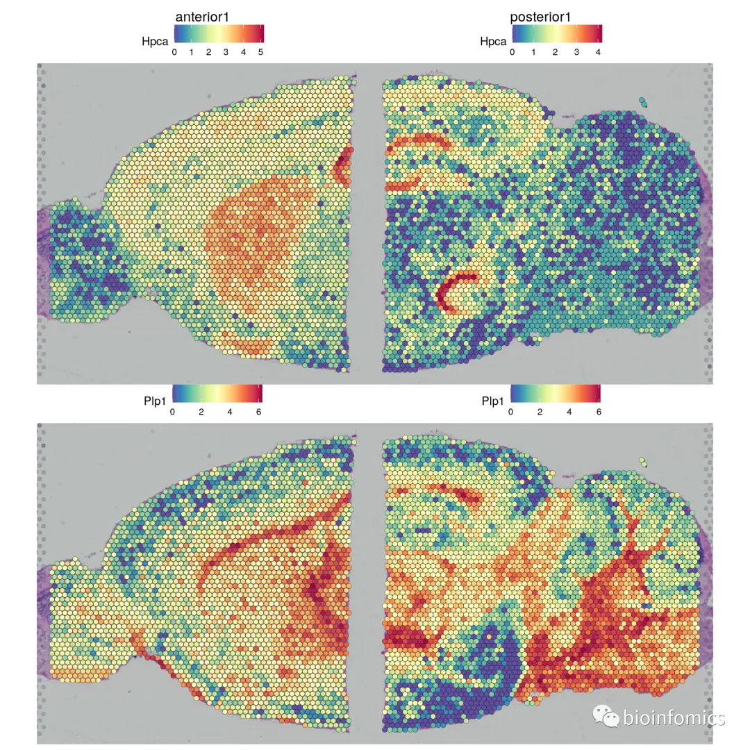 Seurat包学习笔记（三）：Analysis of spatial datasets - 图20