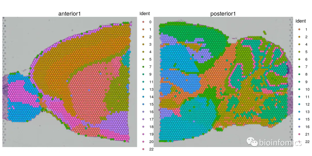 Seurat包学习笔记（三）：Analysis of spatial datasets - 图19