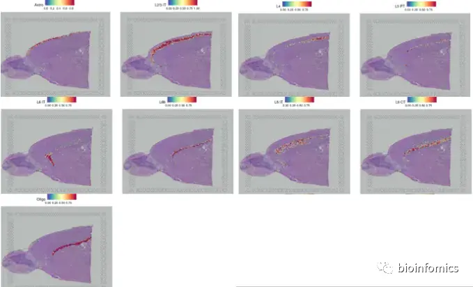 Seurat包学习笔记（三）：Analysis of spatial datasets - 图17
