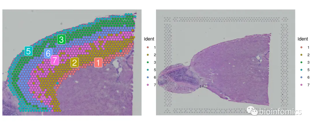 Seurat包学习笔记（三）：Analysis of spatial datasets - 图13