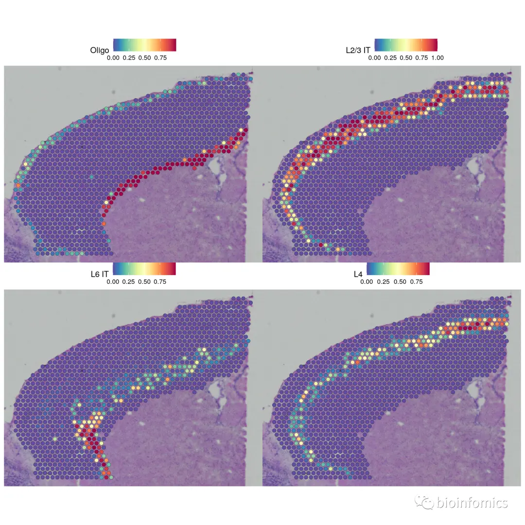 Seurat包学习笔记（三）：Analysis of spatial datasets - 图16