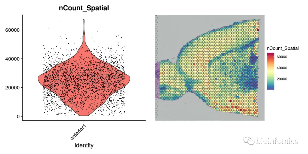 Seurat包学习笔记（三）：Analysis of spatial datasets - 图3