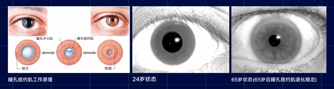 适老化——人眼的光与色 - 图6