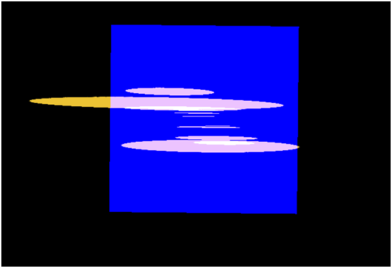 粒子IV